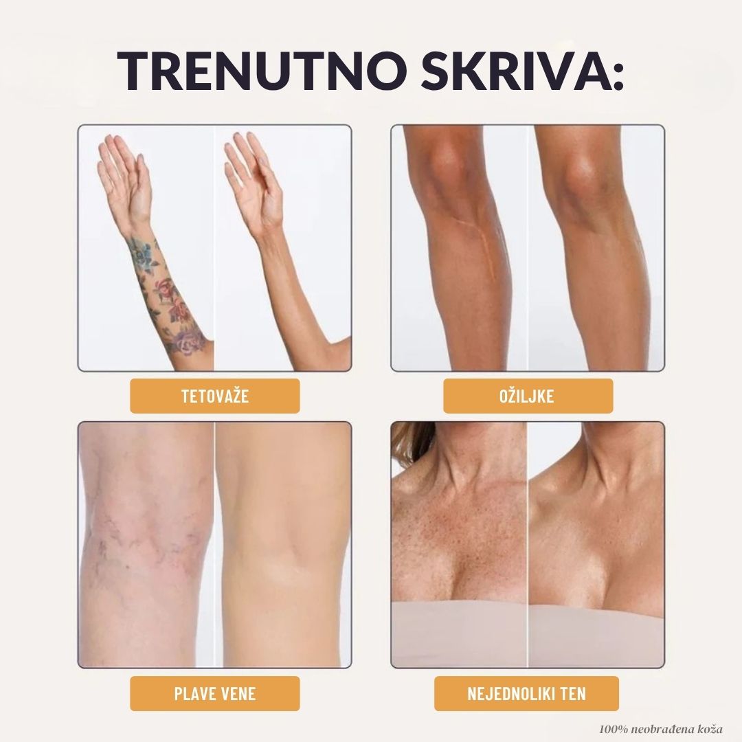 Lorvea Trenutni Korektor za Tijelo