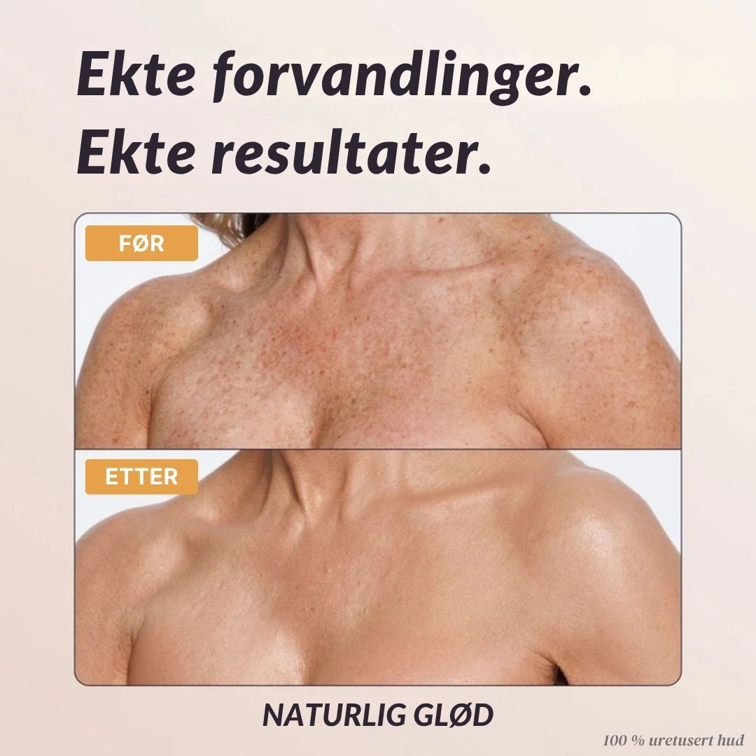 Lorvea Øyeblikkelig Kroppsdekke