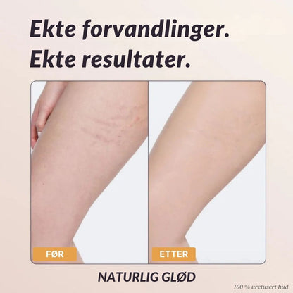Lorvea Øyeblikkelig Kroppsdekke